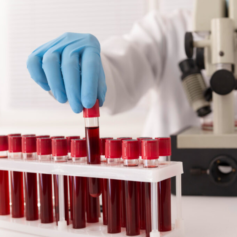 Tubo Ativador de Coagulo 9ml 16x100mm Tampa Vermelha 100un - Medix