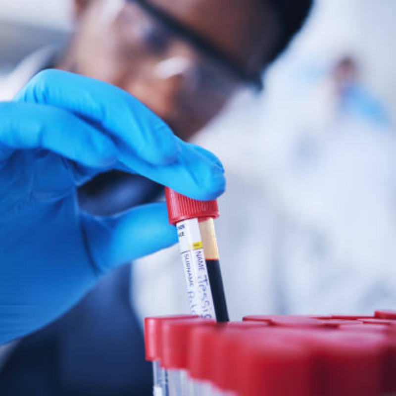 Tubo Ativador de Coagulo 9ml 16x100mm Tampa Vermelha 100un - Medix